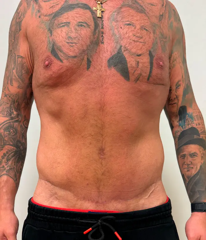 Osoba bez koszulki z portretami wytatuowanymi na klatce piersiowej i ramionach, ubrana w złoty łańcuch i czarne szorty.